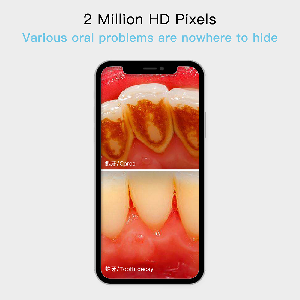 kamera dhëmbësh full hd kamerë dentare orale